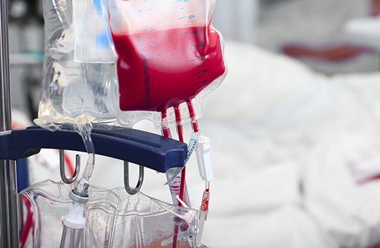 ¿Cómo se identifica y trata la anemia por hemorragia aguda?