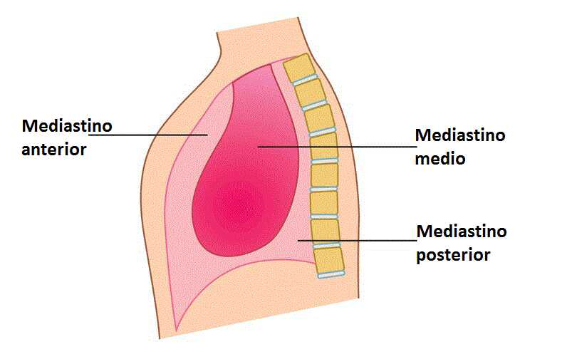 ¿Cuáles son alteraciones frecuentes del mediastino?