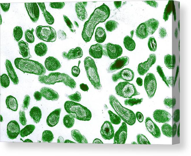 ¿Qué causa la fiebre Q?