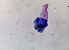 ¿Qué es la donovanosis?