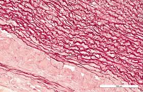 ¿Qué son las fibras elásticas del tejido conjuntivo?