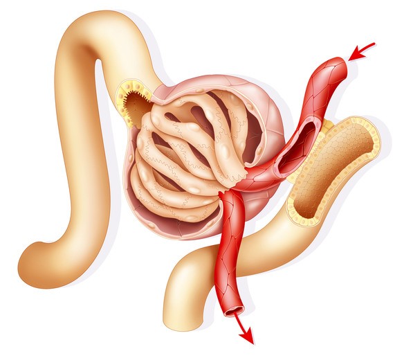 ¿Qué es la glomerulonefritis?