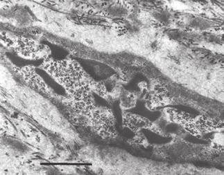 ¿Qué son los fibroblastos y los míoblastos?