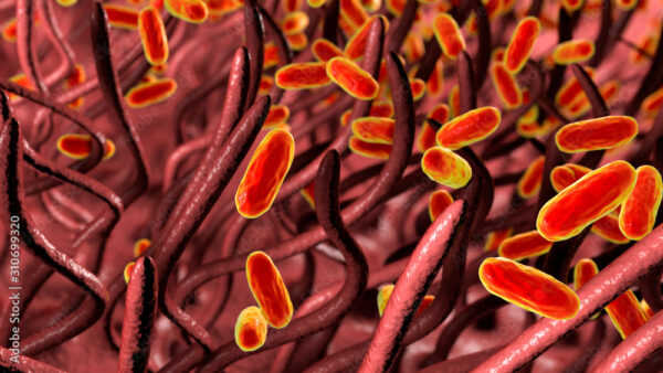 ¿Qué causa la tosferina?