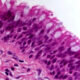 ¿Qué es el epitelio?