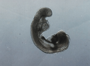 ¿A qué edad gestacional se forma el intestino delgado?