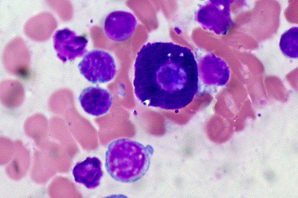 ¿Qué sustancias producen los Mastocitos?