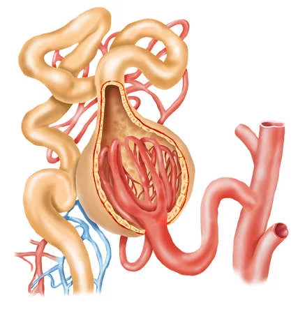 Causas de síndrome nefrótico en adultos