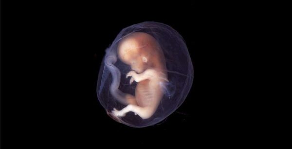 ¿Como se clasifica el aborto?