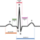 Mediciones en el electrocardiograma