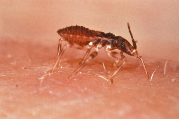 ¿Como se transmite la enfermedad de Chagas?
