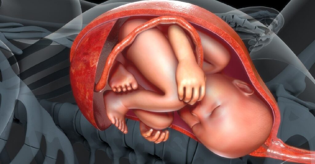 Corioamnionitis y metritis