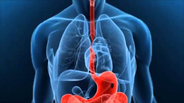 Trastornos estructurales del esófago