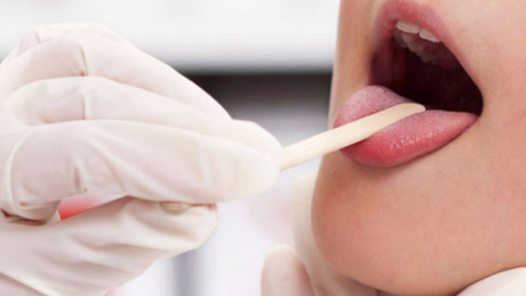 ¿Qué es la difteria?