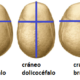 Tipos de cráneo por su forma