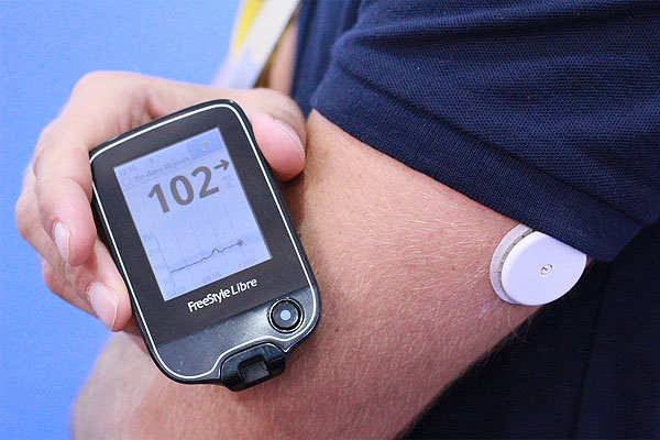 Sistemas de vigilancia contínua de la glucosa