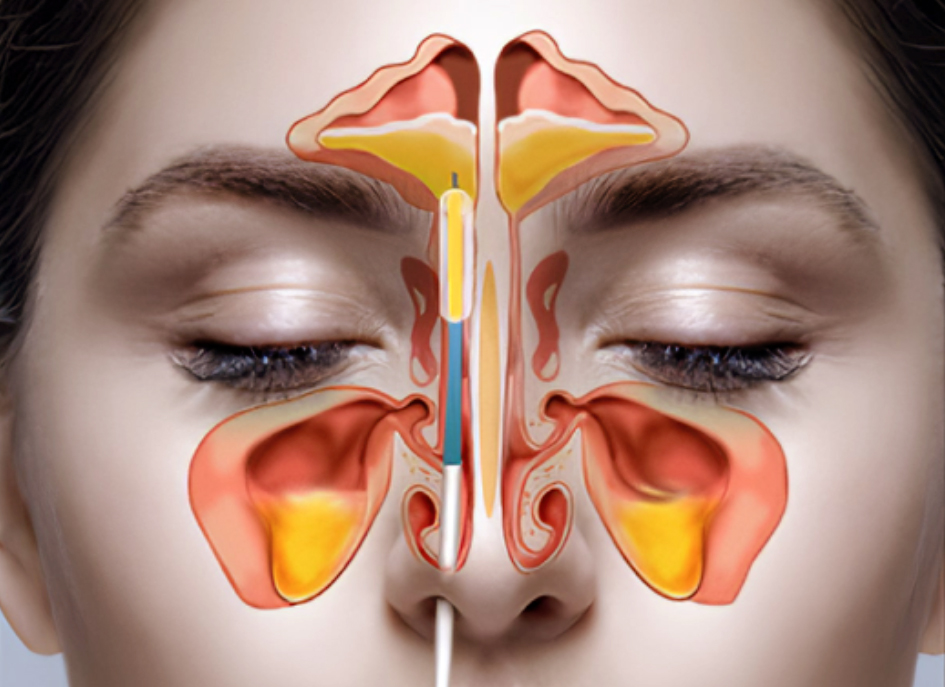 ¿Qué son los senos paranasales?