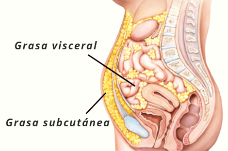 La obesidad visceral es causa de resistencia a la insulina