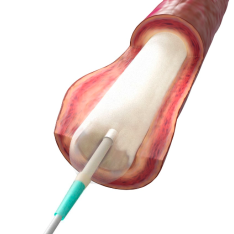 Métodos alternativos para administración de fármacos