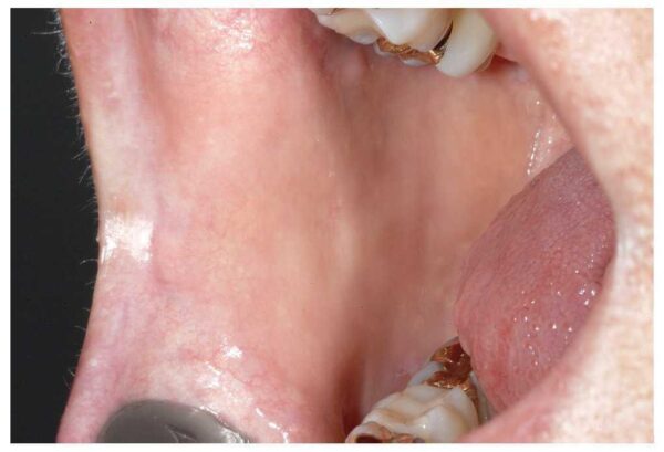 ¿Cuáles son las paredes de la cavidad oral?