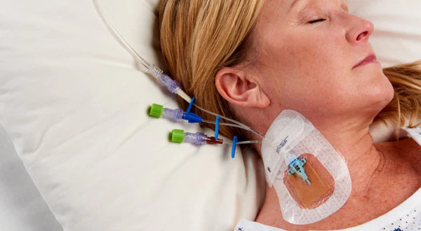 Clasificación de los catéteres venosos centrales de acuerdo al sitio de inserción