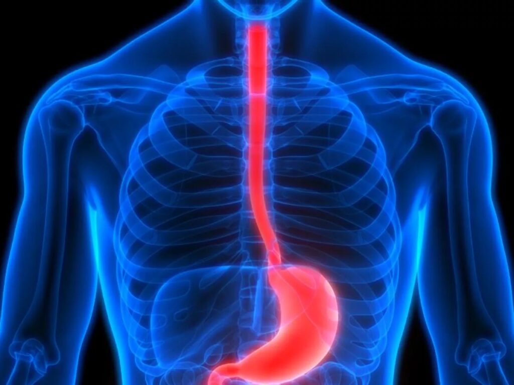 ¿Cuáles son las causas de hemorragia del tubo digestivo alto?