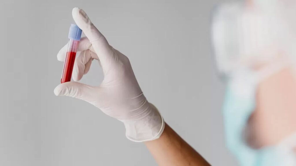 ¿Qué es el hematócrito?