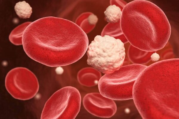 Efectos de la acidosis metabólica sobre la glucosa sanguínea