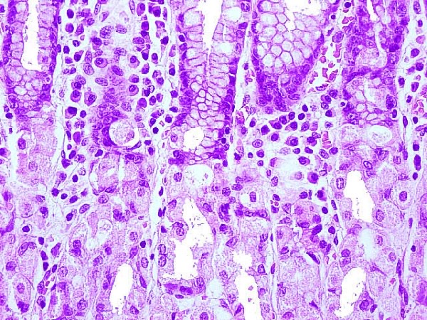 Regeneración de células gástricas