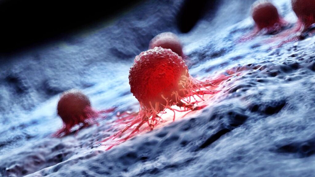 ¿Qué es el cáncer?