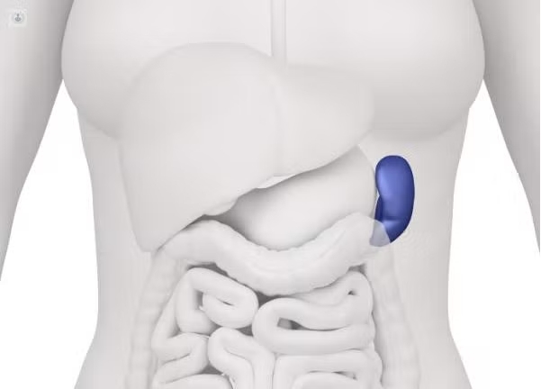 ¿Qué es la esplenectomía?