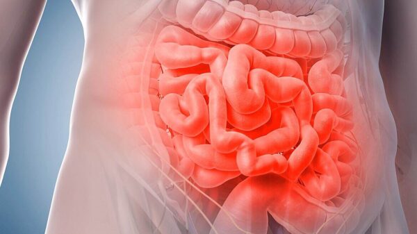 ¿Cuál es la diferencia entre íleon e íleo?
