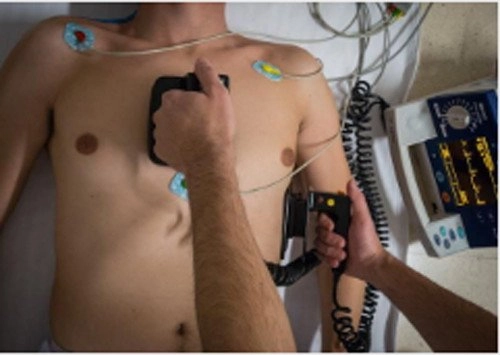 ¿Qué es la cardioversión eléctrica?