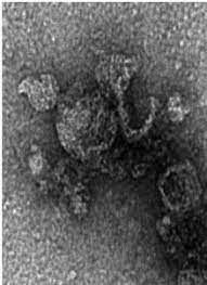 ¿Qué es la ferroptosis?