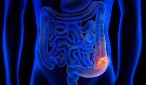 ¿Como es el movimiento del colon?