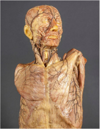 ¿Qué es la anatomía patológica?