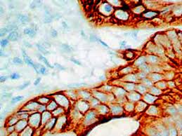 ¿Cuantas citoqueratinas se expresan en las células epiteliales?