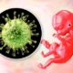 Síndromes clínicos asociados a citomegalovirus