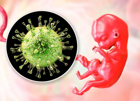 Síndromes clínicos asociados a citomegalovirus