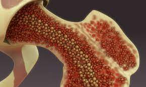 ¿Qué es la cavidad medular de los huesos?