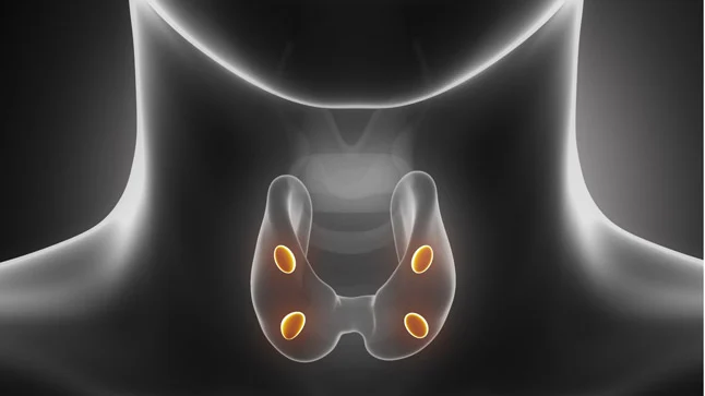 ¿Cuál es la causa más común de hipercalcemia?