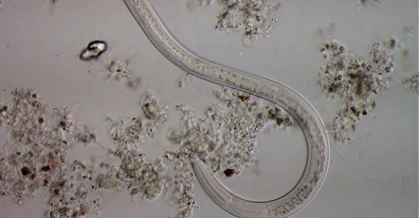 ¿En que parte del mundo es común la anquilostomiosis?