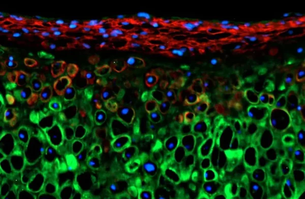 ¿Qué es la condrogénesis?