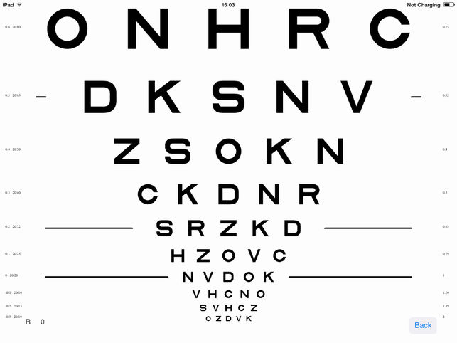 ¿Qué es la agudeza logMAR?