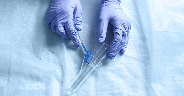 ¿Cuales son las complicaciones de la anoscopía?