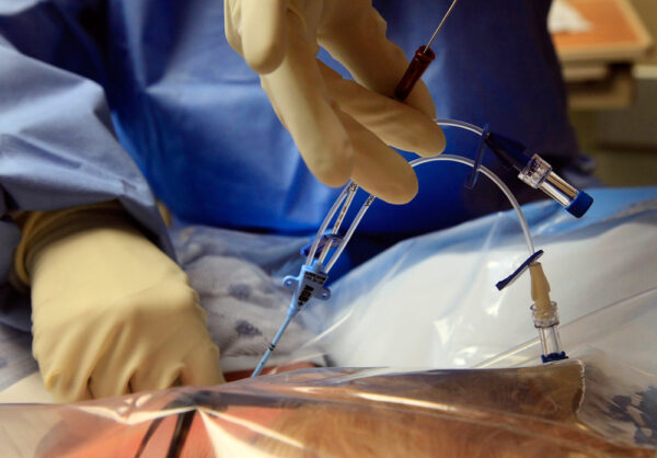 Indicaciones y contraindicaciones de las vías venosas centrales