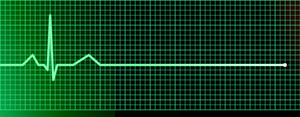 ¿Cuál es el tratamiento de la actividad eléctrica sin pulso/asistolia?