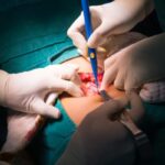 ¿Qué es la anatomía quirúrgica?