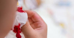 La hemoptisis masiva es una urgencia médica