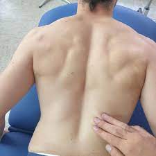 ¿Qué es la anatomía de superficie?